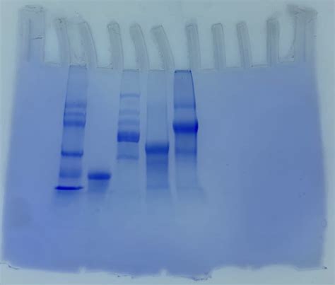 四區劃線法失敗原因|[實驗] Coomassie Blue staining